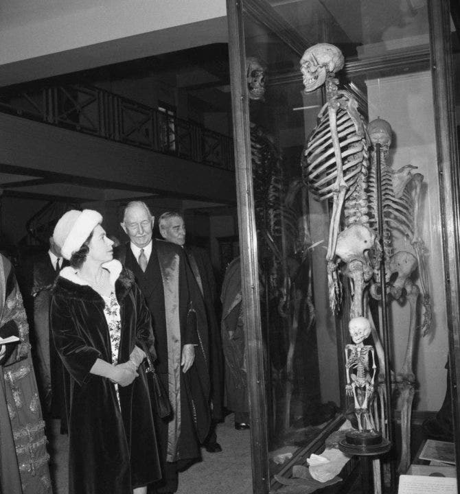London’s ‘Irish Giant’: Museum wants to remove controversial skeleton display