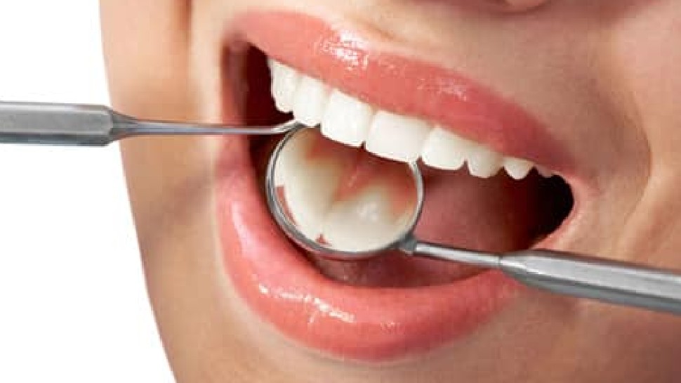 teeth cavity problem follow home remedies to get rid of nsmp | Teeth Cavity: दांतों में कैविटी को इन घरेलू नुस्खों से भगाएं दूर