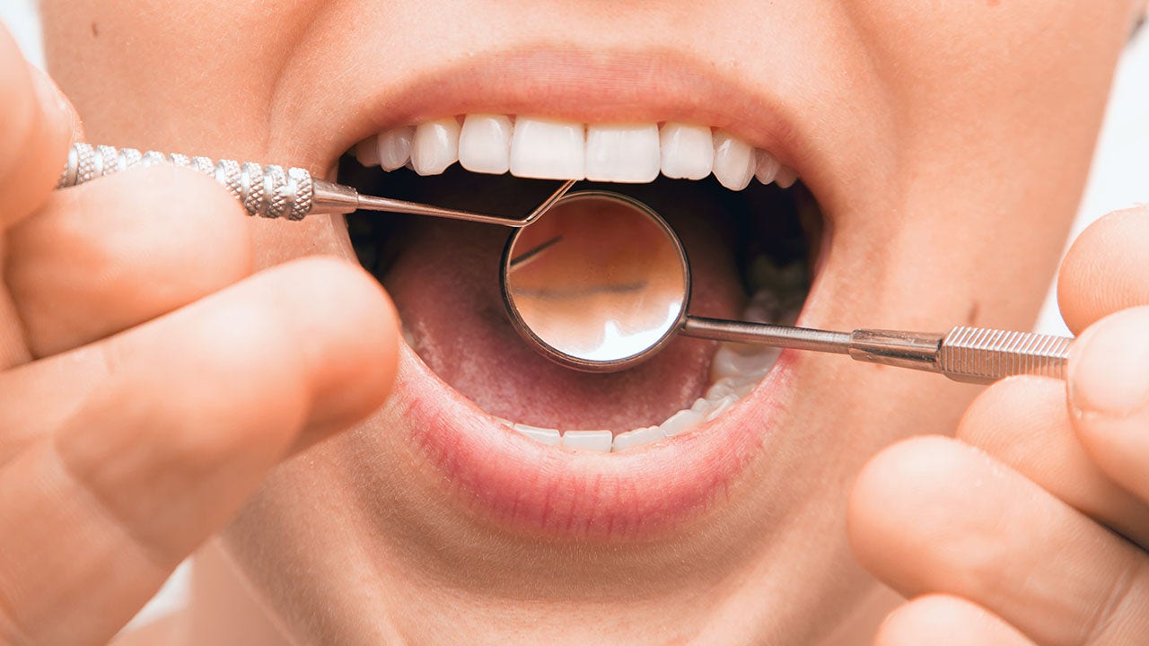 Ask a doc: ‘Why are my gums bleeding after I brush my teeth, and what should I do about it?’