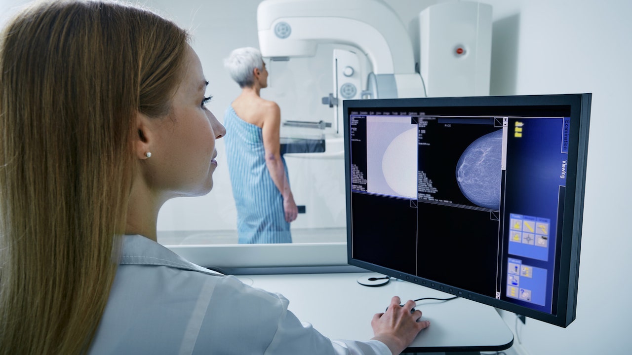 Some breast cancer patients could be at risk of another type of cancer, study reveals