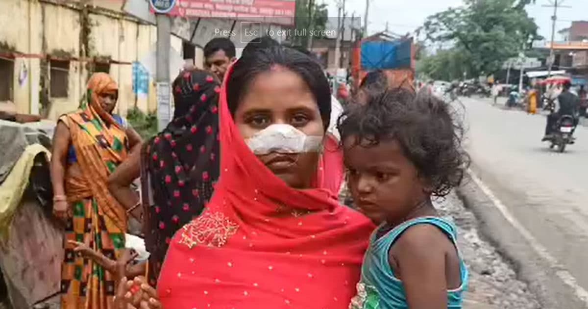 UP News: लखीमपुर खीरी में बच्चे को पीटने के विवाद में पति ने महिला की दांतों से चबाई नाक, जेब में लेकर भागा, भेजा गया जेल