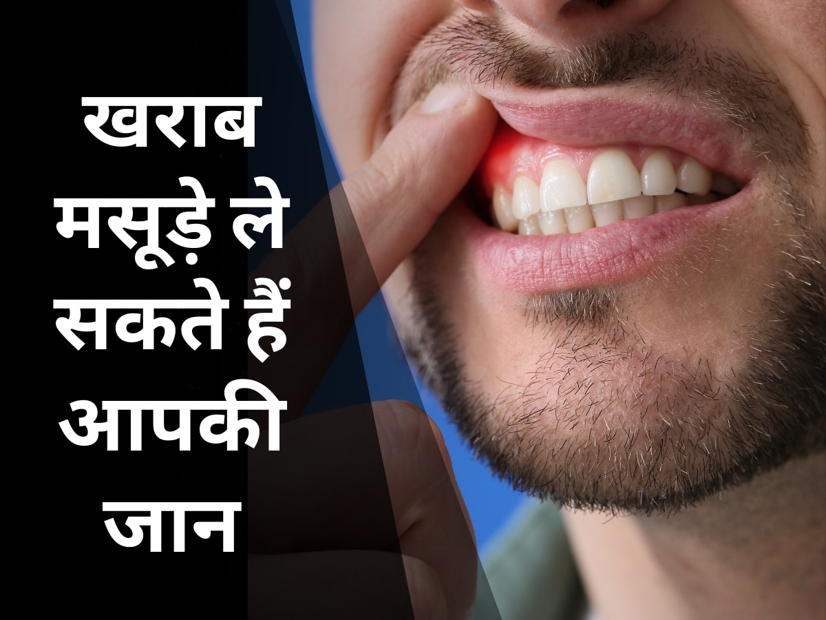 Risk of cardiovascular disease increase due to bad gums more than 15 million people die from heart disease | खराब मसूड़ों से इस बीमारी का अधिक खतरा, हर साल होती है 1.5 करोड़ से ज्यादा लोगों की मौत
