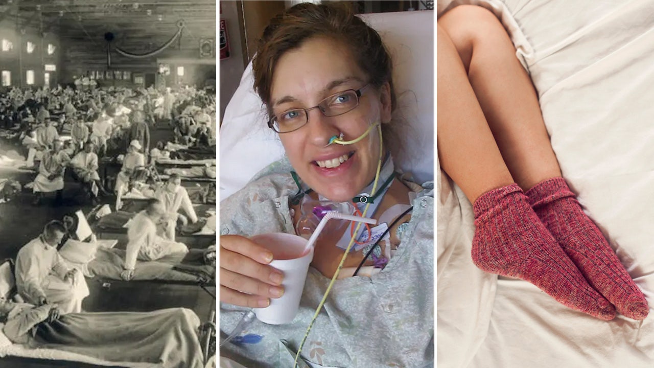 Woman loses leg to flu, skeletons reveal pandemic truths, and expert shares sleeping tip
