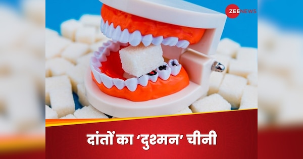 How Sugar Is Injurious To Teeth Oral Health Cheeni Khane Ke Nuksan Cavity Bad Breath | Teeth: दांतों के लिए क्यों नुकसानदेह है चीनी का सेवन? ओरल हेल्थ का हो जाता है ‘कबाड़ा’