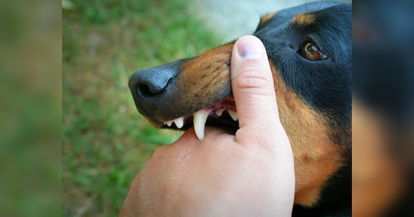 Can someone die after receiving rabies vaccine post dog bite doctors told shocking thing | Rabies: कुत्ते के काटने के बाद रेबीज का टीका लगवाने से भी क्या हो सकती है मौत? क्या कहते हैं डॉक्टर